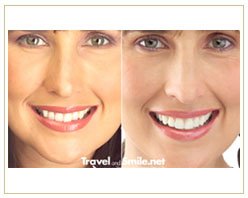 Slider image (2) Travel and Smile